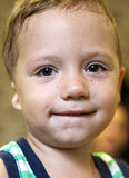 Two Year Old Anton has hearing loss on his right side. He needs surgery to help him hear normally.