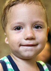 Two Year Old Anton has hearing loss on his right side. He needs surgery to help him hear normally.